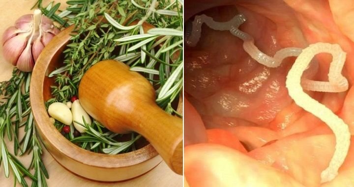 The best food, vitamin and supplements to kill parasites and grow up your health